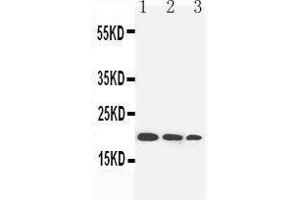 Image no. 1 for anti-Interleukin 10 (IL10) (AA 46-60), (N-Term) antibody (ABIN3042618)
