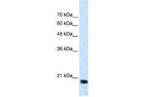 Image no. 2 for anti-Signal Sequence Receptor, beta (Translocon-Associated Protein Beta) (SSR2) antibody (ABIN630453)