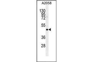 Image no. 3 for anti-Suppressor of Cytokine Signaling 4 (SOCS4) (AA 234-262) antibody (ABIN954879)
