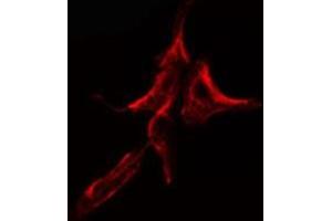 Image no. 1 for anti-KDEL (Lys-Asp-Glu-Leu) Endoplasmic Reticulum Protein Retention Receptor 2 (KDELR2) antibody (ABIN6258945)