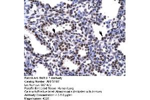 Image no. 3 for anti-BarH-Like Homeobox 2 (BARHL2) (Middle Region) antibody (ABIN2779393)