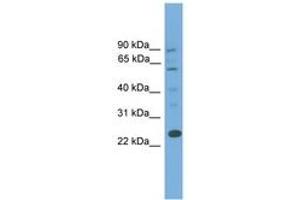 Image no. 1 for anti-B-Cell CLL/lymphoma 7A (BCL7A) (AA 107-156) antibody (ABIN6745154)