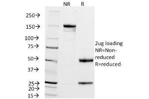 anti-zeta-Chain (TCR) Associated Protein Kinase 70kDa (ZAP70) (AA 1-254) antibody