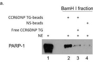 Image no. 8 for anti-Poly (ADP-Ribose) Polymerase 1 (PARP1) (Center) antibody (ABIN2854798)