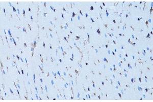 Immunohistochemistry of paraffin-embedded Rat heart using FABP4 Polyclonal Antibody at dilution of 1:100 (40x lens).