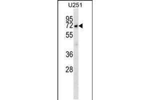 Image no. 1 for anti-McKusick-Kaufman Syndrome (MKKS) (AA 408-437), (C-Term) antibody (ABIN5537168)
