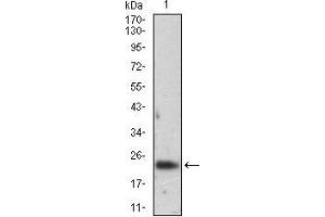 Image no. 1 for anti-Ferritin, Light Polypeptide (FTL) (AA 1-157), (full length) antibody (ABIN2682990)