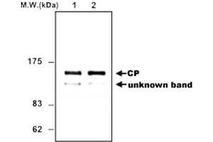 Image no. 1 for anti-Ceruloplasmin (Ferroxidase) (CP) antibody (ABIN532657)