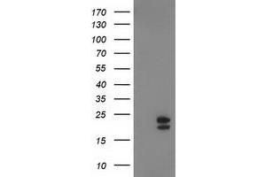 Image no. 1 for anti-NADH Dehydrogenase (Ubiquinone) 1 beta Subcomplex, 9, 22kDa (NDUFB9) (AA 3-179) antibody (ABIN2727033)