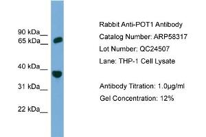 Image no. 2 for anti-Protection of Telomeres 1 (POT1) (Middle Region) antibody (ABIN2787632)