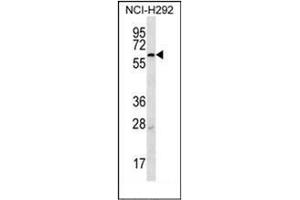 Image no. 2 for anti-Membrane-Bound Transcription Factor Peptidase, Site 2 (MBTPS2) (AA 14-44), (N-Term) antibody (ABIN953342)