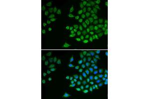 Image no. 5 for anti-Protein tyrosine Phosphatase, Non-Receptor Type 2 (PTPN2) antibody (ABIN3022585)