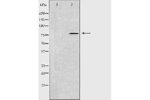Image no. 1 for anti-Glucosamine (UDP-N-Acetyl)-2-Epimerase/N-Acetylmannosamine Kinase (GNE) antibody (ABIN6258893)