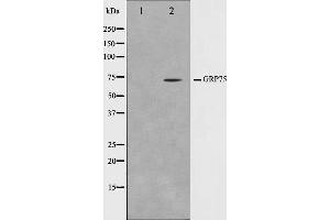 Image no. 3 for anti-Heat Shock 70kDa Protein 9 (Mortalin) (HSPA9) antibody (ABIN6262097)