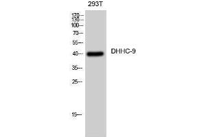 Image no. 1 for anti-Zinc Finger, DHHC-Type Containing 9 (ZDHHC9) (C-Term) antibody (ABIN3184303)