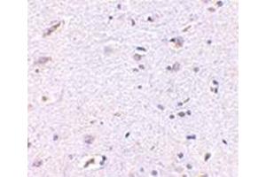 Image no. 1 for anti-Syntaphilin (SNPH) (N-Term) antibody (ABIN500851)