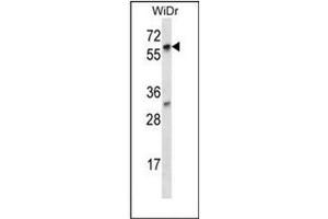 Image no. 1 for anti-La Ribonucleoprotein Domain Family, Member 7 (LARP7) (AA 526-556), (C-Term) antibody (ABIN953138)