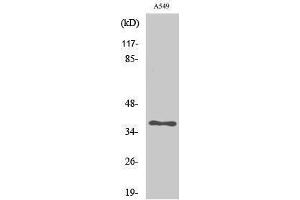 Image no. 1 for anti-Aldo-Keto Reductase Family 1, Member E2 (AKR1E2) (Internal Region) antibody (ABIN3183228)