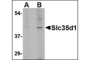 Image no. 2 for anti-Solute Carrier Family 35 (UDP-Glucuronic Acid/UDP-N-Acetylgalactosamine Dual Transporter), Member D1 (SLC35D1) (C-Term) antibody (ABIN500740)