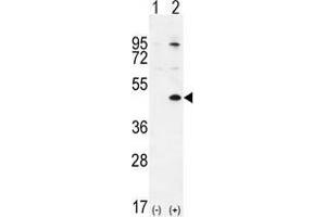 Image no. 2 for anti-TGFB-Induced Factor Homeobox 1 (TGIF1) (AA 215-245), (Middle Region) antibody (ABIN955179)
