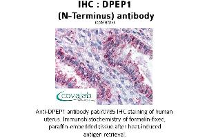 Image no. 2 for anti-Dipeptidase 1 (Renal) (DPEP1) (N-Term) antibody (ABIN1733739)