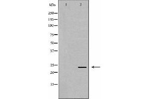 Image no. 1 for anti-MAD2 Mitotic Arrest Deficient-Like 1 (Yeast) (MAD2L1) (Internal Region) antibody (ABIN6263048)