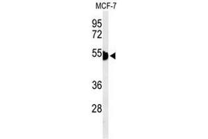 Image no. 2 for anti-Keratin 1 (KRT1) (AA 422-451), (Middle Region) antibody (ABIN951809)