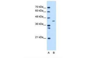 MTCH1 anticorps  (C-Term)