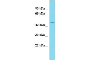Image no. 1 for anti-BPI Fold Containing Family B, Member 3 (BPIFB3) (C-Term) antibody (ABIN2791410)