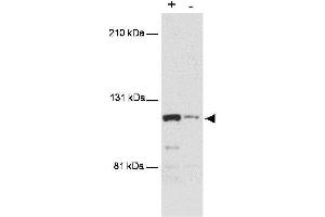 Western blot using  anti-MTBP antibody shows detection of a band ~110 kDa corresponding to human MTBP (arrowhead).