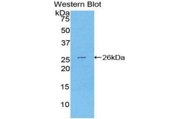 anti-Transportin 1 (TNPO1) (AA 597-837) antibody