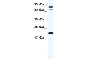 Image no. 1 for anti-Zinc Finger Protein 287 (ZNF287) (N-Term) antibody (ABIN925862)