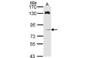 Image no. 1 for anti-Hermansky-Pudlak Syndrome 6 (HPS6) (Internal Region) antibody (ABIN2856529)