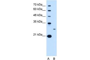 Image no. 1 for anti-Tetraspanin 15 (TSPAN15) (C-Term) antibody (ABIN2782784)