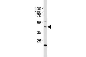 Image no. 4 for anti-E2F Transcription Factor 1 (E2F1) (AA 342-371) antibody (ABIN3030786)