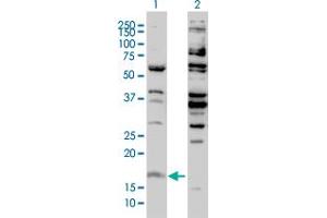 Image no. 2 for anti-H3 Histone, Family 3B (H3.3B) (H3F3B) (AA 1-136) antibody (ABIN561220)