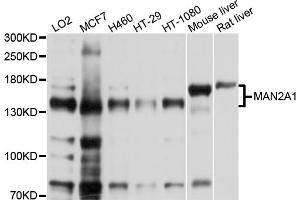 Image no. 1 for anti-Mannosidase, Alpha, Class 2A, Member 1 (MAN2A1) antibody (ABIN6566822)