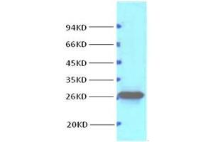 Image no. 4 for anti-B-Cell CLL/lymphoma 2 (BCL2) antibody (ABIN3181112)