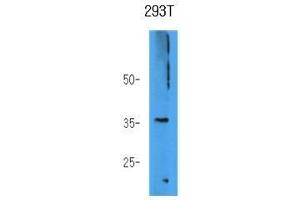 Image no. 1 for anti-Aldo-Keto Reductase Family 7, Member A3 (Aflatoxin Aldehyde Reductase) (AKR7A3) antibody (ABIN933773)
