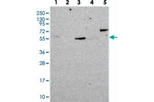 Image no. 2 for anti-Coronin, Actin Binding Protein, 2A (CORO2A) antibody (ABIN5575852)