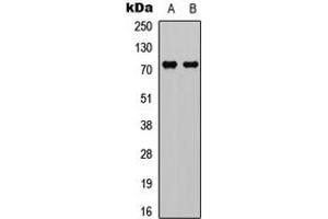 Image no. 1 for anti-DEAD (Asp-Glu-Ala-Asp) Box Polypeptide 3, X-Linked (DDX3X) (Center) antibody (ABIN2972465)