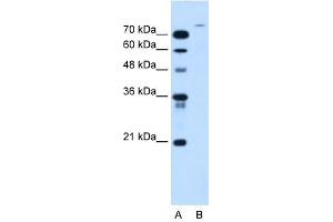 Image no. 1 for anti-Ubiquitin Specific Peptidase 48 (USP48) (Middle Region) antibody (ABIN630347)