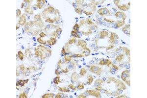 Immunohistochemistry of paraffin-embedded Human stomach using PIK3CA Polyclonal Antibody at dilution of 1:100 (40x lens).