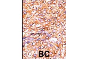 Image no. 3 for anti-Dual Specificity Phosphatase 10 (DUSP10) (AA 1-30), (N-Term) antibody (ABIN392871)