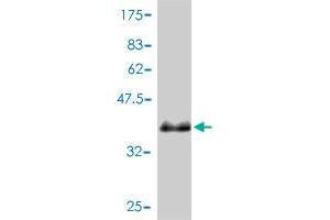 Image no. 2 for anti-Presenilin Enhancer 2 Homolog (PSENEN) (AA 1-101) antibody (ABIN565943)