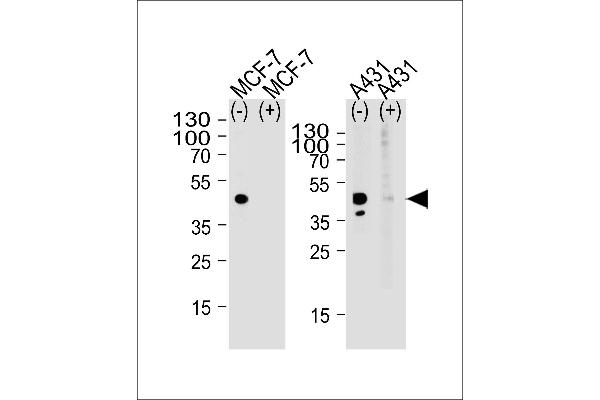 Calcitonin Receptor anticorps  (AA 465-494)