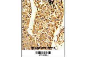 Immunohistochemistry (IHC) image for anti-Cytochrome P450, Family 2, Subfamily C, Polypeptide 18 (CYP2C18) antibody (ABIN2158444)