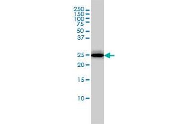 anti-Regulator of G-Protein Signaling 2 (RGS2) (AA 111-211) antibody