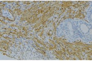Image no. 2 for anti-Fibroblast Growth Factor 18 (FGF18) antibody (ABIN6257179)