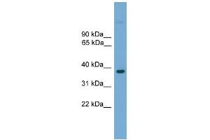 Image no. 1 for anti-Forkhead Box E1 (Thyroid Transcription Factor 2) (FOXE1) (C-Term) antibody (ABIN2780169)